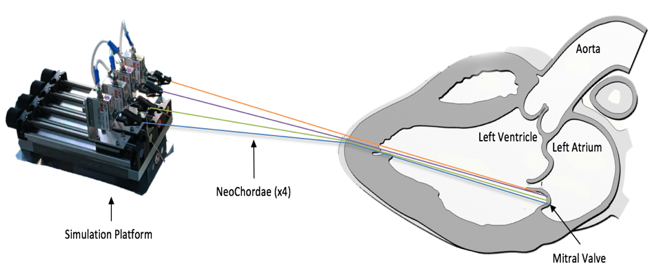 Schema coeur neocordes