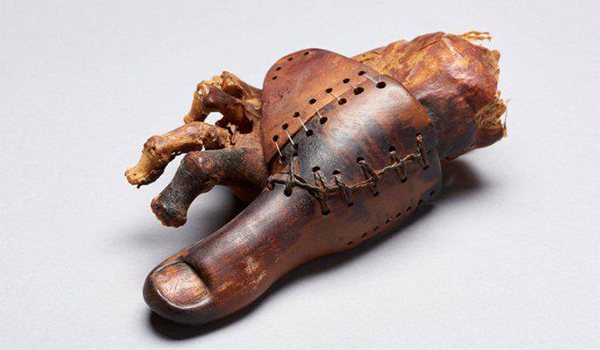 Un millénaire avant notre ère, les Égyptiens savaient déjà amputer et remplacer un membre par une prothèse de bois et de cuir 
